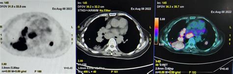 PET / CT Scan & Nuclear Medicine .
